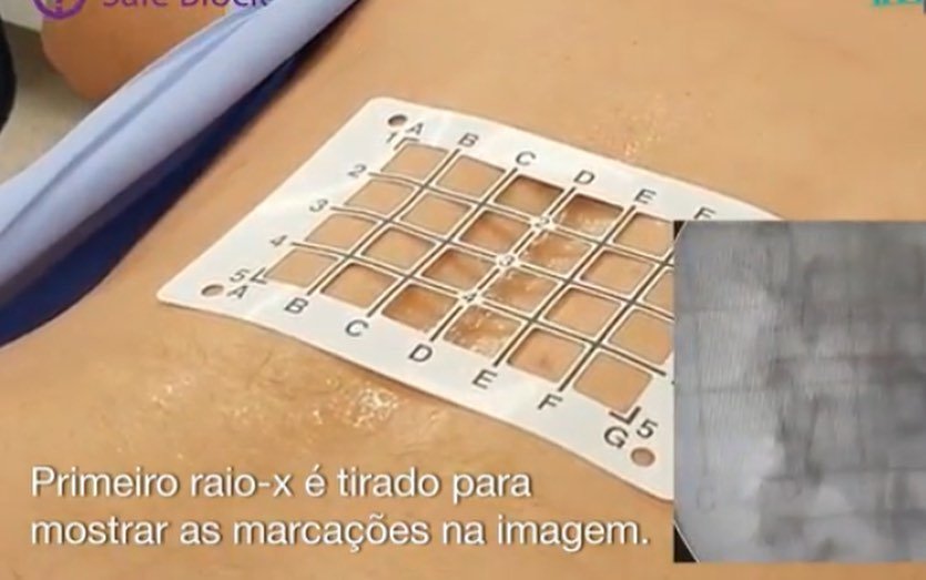 AllMedic KIT SAFE BLOCK