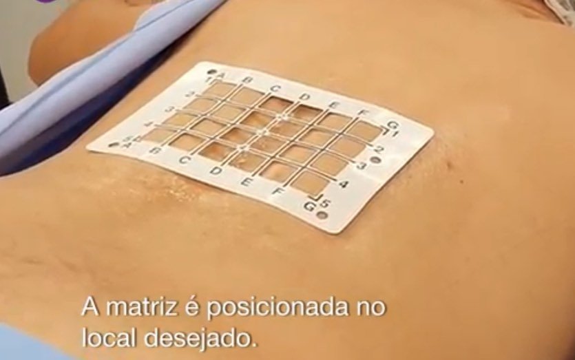 AllMedic KIT SAFE BLOCK